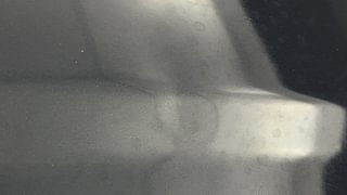 Used 2021 Hyundai Venue [2019-2022] SX 1.5 CRDI Diesel Manual dents MINOR SCRATCH
