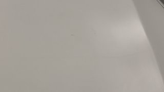 Used 2018 Mercedes-Benz E-Class [2017-2021] E200 Avantgarde Petrol Automatic dents MINOR SCRATCH
